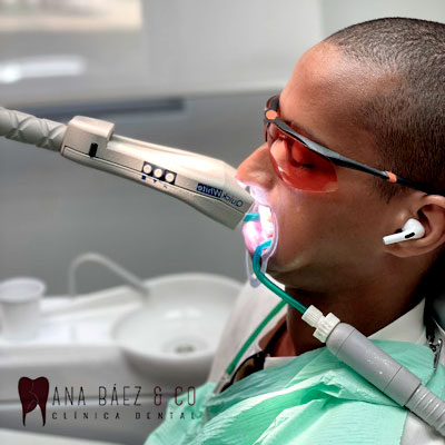 blanquemiento dental ana baez