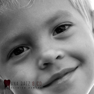 blanquemiento dental ana baez