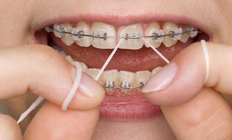 el-efecto-del-tabaco-en-una-salud-bucodental