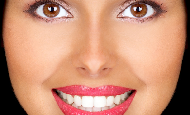 invisalign-en-adultos