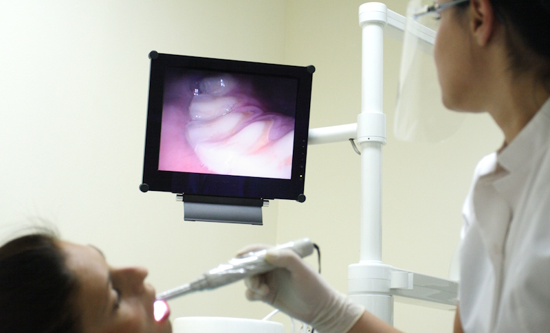 que-pasa-si-no-tengo-hueso-para-un-implante