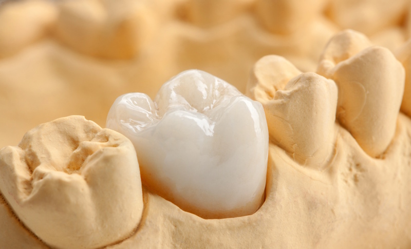 invisalign-en-adultos